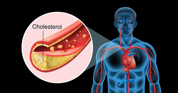 Giảm cholesterol trong máu